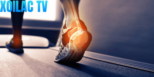 Gait Analysis – Phân tích dáng chạy là gì?